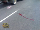 Велосипедист случайно упал под колеса легковушки. Кровь брызнула на асфальт. Фото