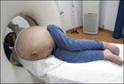 Китаянке отрезали невероятных размеров опухоль. Фото