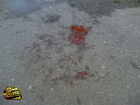 Пьяный киевлянин попытался перебежать дорогу, и… кровь ляпнула на асфальт. Фото