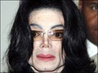 Страшные последствия экспериментов, которые проводил над собой Майкл Джексон. Фото