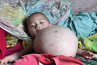 Беременная полуторагодовалая девочка из Китая. Интересные фото
