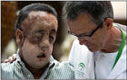 Испанские врачи пересадили мужчине новое лицо. Фото