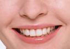 Ученые выдумали новый способ лечения зубов