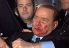 Человека, разбившего лицо Берлускони, определили в психушку