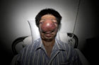 Китайцу  вырежут гигантскую опухоль из носу. Фото