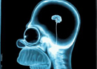 Как лечить эпилепсию истолченным человеческим черепом… Список самых нелепых и странных способов победить болезнь