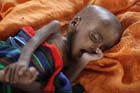 Не хватает ста долларов на новенький iPhone? А в это время в Африке от голода умирают дети. Фото