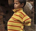 Семилетнему мальчику из Индии сделали самую необычную операцию в мире. Фото