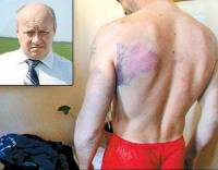 Избитые Бойчуком рыбаки претензий к драчуну больше не имеют. А жители Заставной с пеной у рта доказывают, что экс-чиновник – просто душка