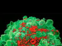 Оказывается, некоторые иммунные клетки человека могут отражать атаку ВИЧ-инфекции. Правда, в терапии это пока использовать не научились
