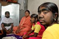 Журналисты разыскали в Индии семью настоящих оборотней. Фото