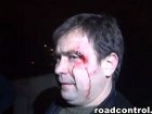 «Дорожный контроль» утверждает, что их журналиста «убивали» на глазах у бездействующей милиции