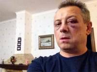 Неизвестные жестоко избили депутата от «УДАР»
