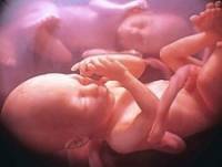 Жертвы абортов. Отделяем науку от либеральной альтернативы