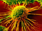 Ученые научили раковые клетки убивать самих себя