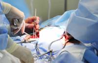 Во Франции пациенту впервые в мире пересадили искусственное сердце