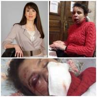 Надо же. Янукович велел Захарченко и Пшонке лично заняться делом о нападении на Чорновол