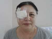 Активистка Евромайдана потеряла зрение, пытаясь защитить сына от побоев