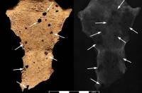 На костях скелета, которому более 3 тысяч лет, ученые обнаружили… следы рака