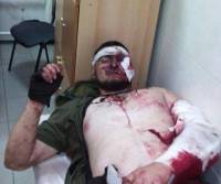 В Сети появились фотографии с телефона раненого чеченского боевика из Донецка