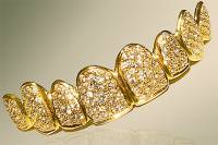 Улыбка на миллион долларов. Стоматологи из Дубая создали «самую дорогую улыбку в мире»