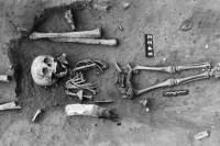 Во Франции раскопали древнейший скелет человека с признаками синдрома Дауна