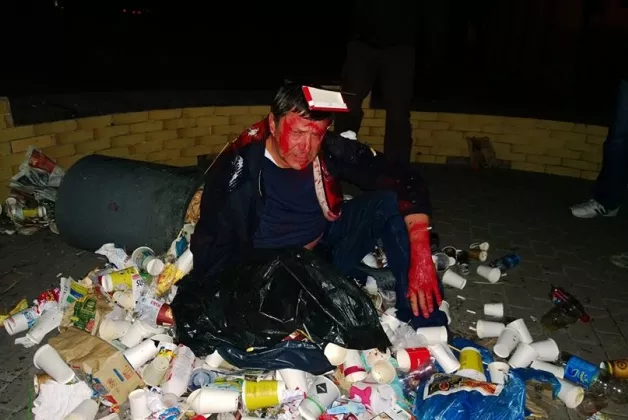 В Киеве политическая гопота бросила в мусорник и облила краской депутата Пилипишина