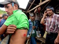 В Никарагуа продолжаются столкновения демонстрантов с полицией