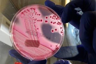 Всемирная организация здравоохранения определила дюжину самых опасных для человека бактерий