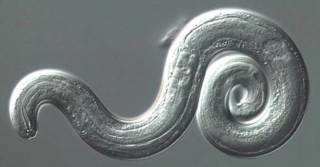 Американские ученые опасаются эпидемии вызывающих паралич мозговых червей