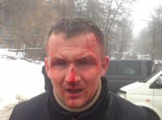В Киеве «наемники Кличко» до потери сознания избили народного депутата