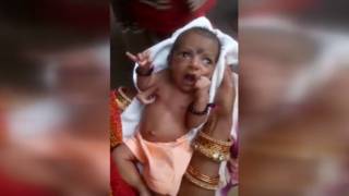 В Индии родилась девочка с тремя руками. Родители не торопятся ампутировать лишнее