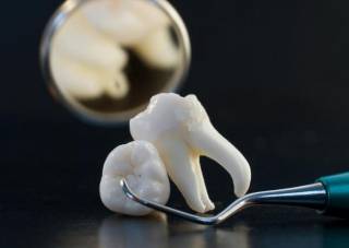 Как оказалось, плохие зубы могут привести к онкологии