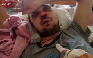 В Киеве водитель маршрутки жестоко избил пассажира за то, что тот попросил его передать сдачу