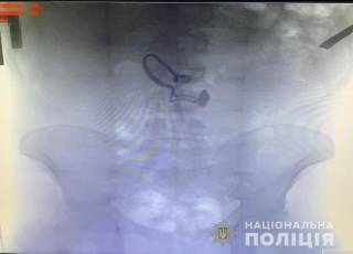 Жители Киева задержали грабителя, который съел цепочку своей очередной жертвы
