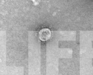 Российская лаборатория опубликовала фото коронавируса, переполошившего весь мир