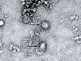 Ученые выяснили, когда на Земле появился предок коронавируса