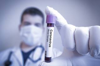 В Украине научились лечить коронавирус, – Степанов