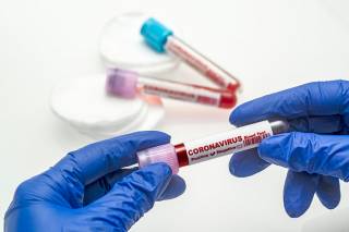 В Киеве лабораторный центр Минздрава прекращает обследование частных лиц на коронавирус