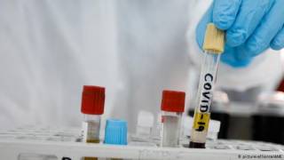 Ученые призывают изменить стратегию борьбы с коронавирусом
