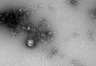 Ученым впервые удалось сфотографировать британский штамм коронавируса