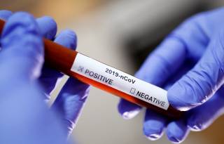 В Минздраве рассказали, можно ли подхватить коронавирус в результате вакцинации