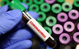 В ВОЗ назвали неожиданную возможную причину появления коронавируса