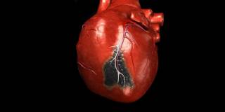 Найдена взаимосвязь между групповой крови человека и вероятностью инфаркта