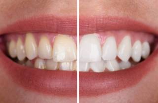 Что такое эстетическая стоматология