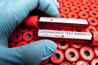 В Киеве две туркомпании попались на подделке тестов на коронавирус