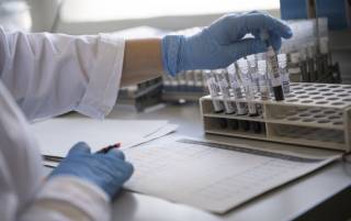 В Минздраве объяснили, нужно ли сдавать тест на антитела после вакцинации