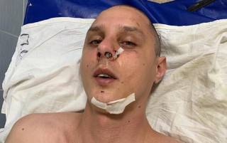 В Киеве сломали череп известному музыкальному продюсеру