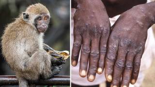 ВОЗ зафиксировала два новых смертельных случая от оспы обезьян