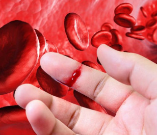 Розторопша: згущує кров чи розріджує?